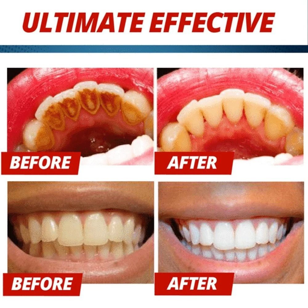 Pemutih gigi Baking Soda Toothpaste Pasta Gigi Pemutih  Penghilang Plak Gigi with Natural Essence Odol Pemutih Gigi Penghilang Plak Gigi
