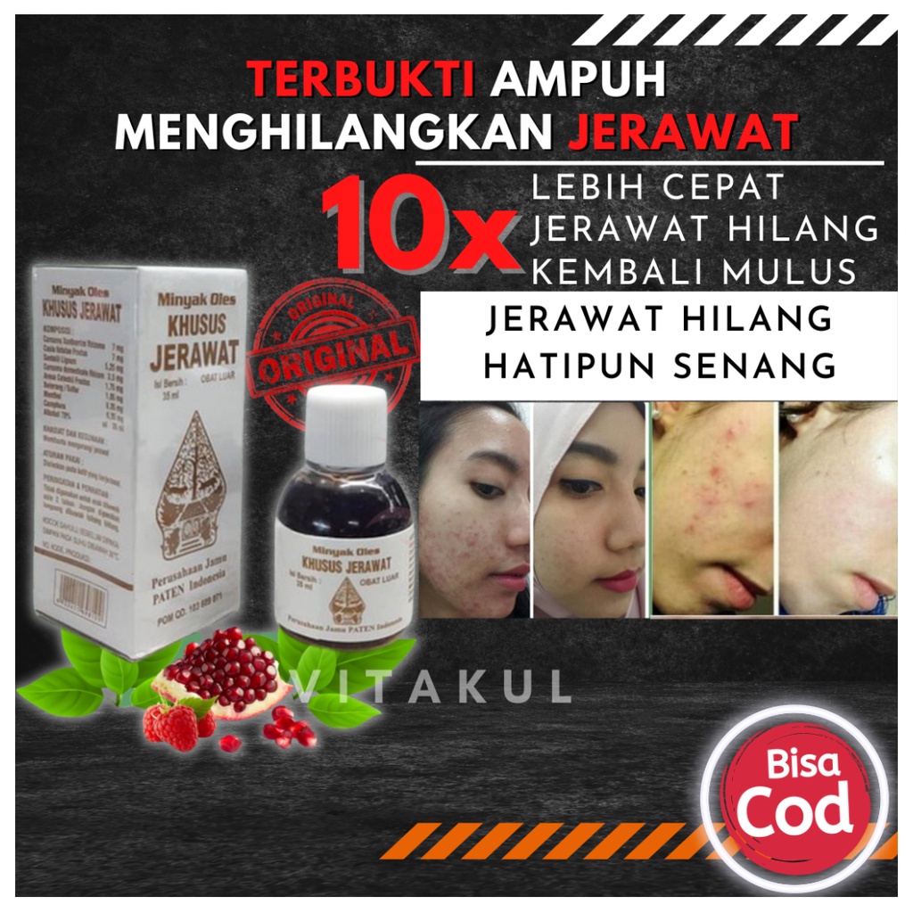 ORIGINAL! Minyak Oles Khusus Jerawat Cap Wayang terbaik / Obat Jerawat Ampuh / Penghilang Jerawat da