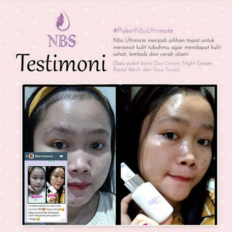 NBS SKINCARE ULTIMATE NEW-3