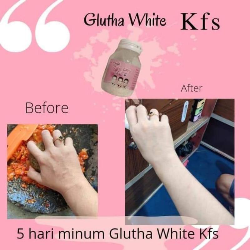 GLUTA KFS MINUMAN COLLAGEN BPOM PEMUTIH BADAN AMPUH LEBIH CERAH POMEGLOW PROMIL