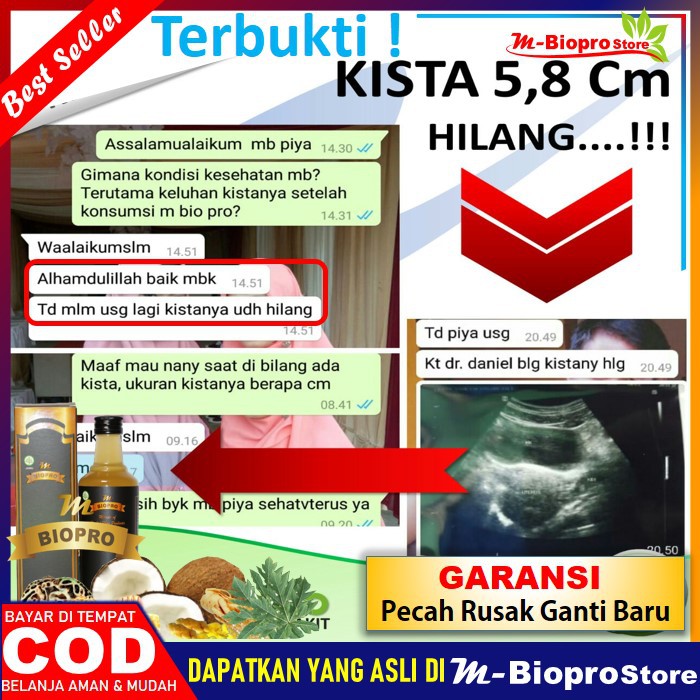 

obat kista ovarium mbiopro herbal m biopro asli original ampuh atasi kista bartholin tanpa oprasi