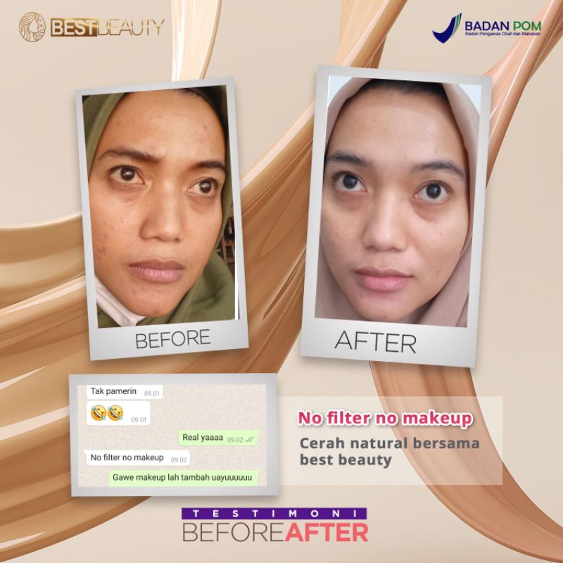 Pemutih wajah Night Cream Ori by Best Beauty Ultimate | Brightening | Acne | Ultimate BPOM