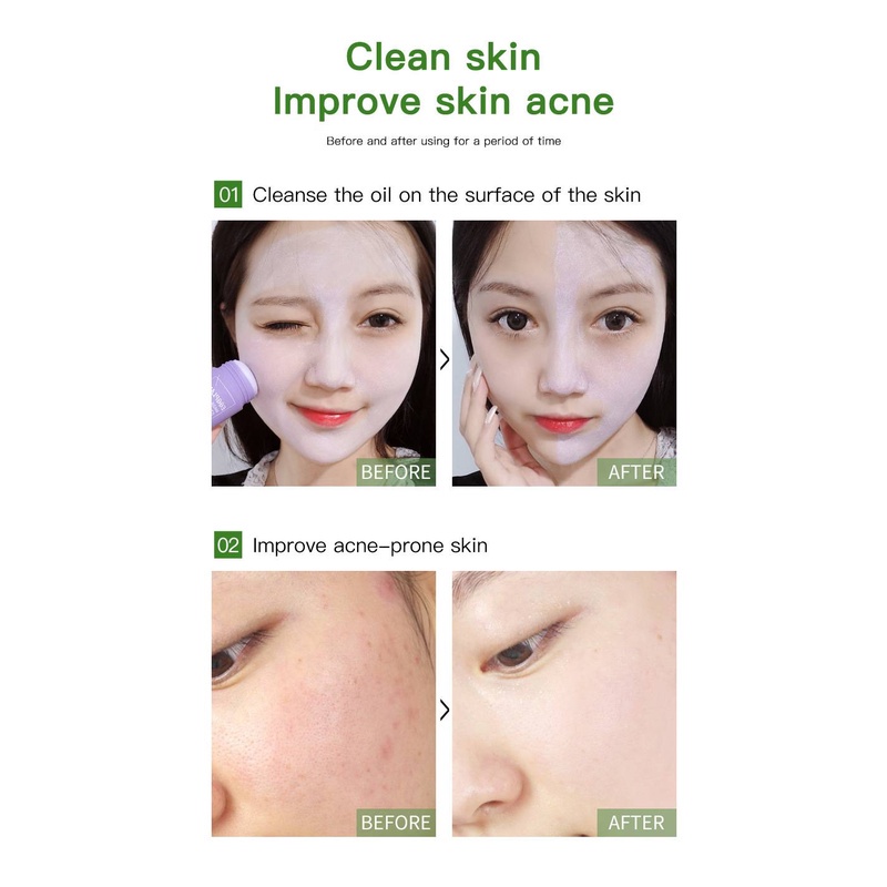 [100% Asli + Real Pict] Green Mask Stick Original Untuk Jerawat Wanita dan Pria Pembersih Komedo Pori - Pori