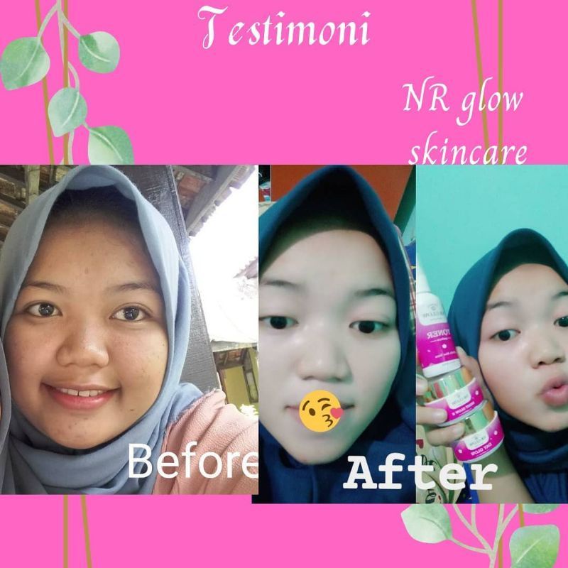 Paket pemutih wajah NR GLOW skinciare