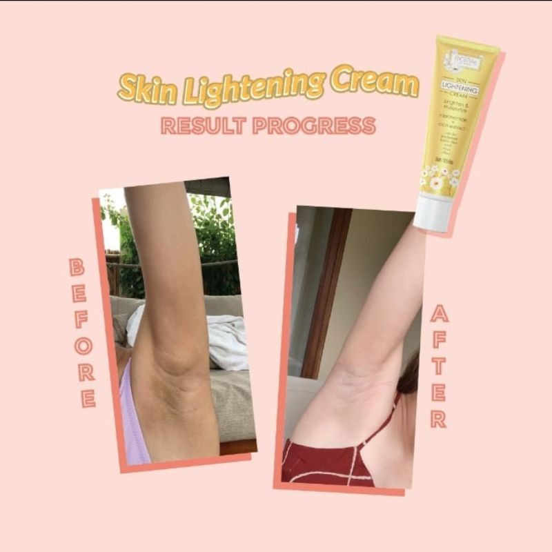 Noera Skin Lightening Cream / armpit cream