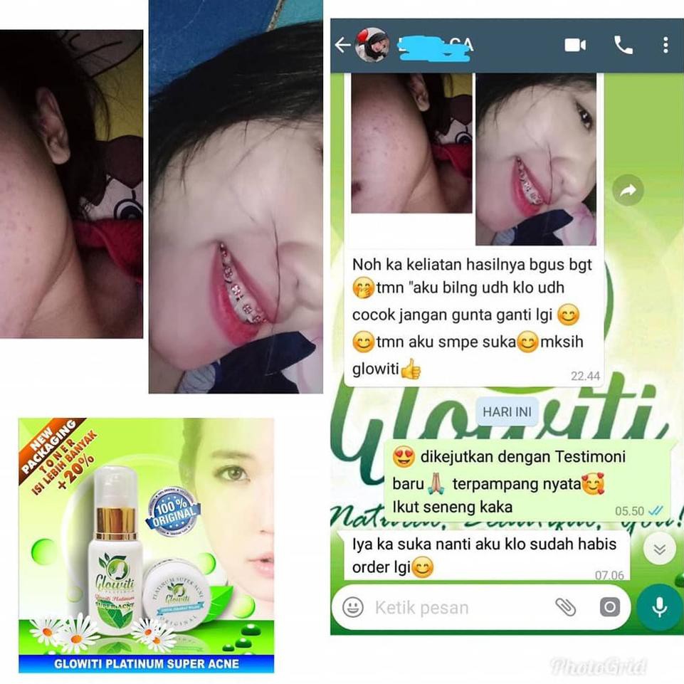 glowiti platinum super acne