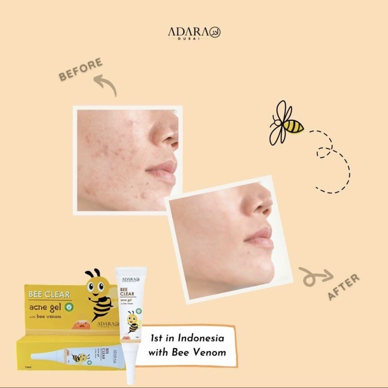 ADARA - Bee Clear Acne Gel With Bee venom / Obat Totol Jerawat