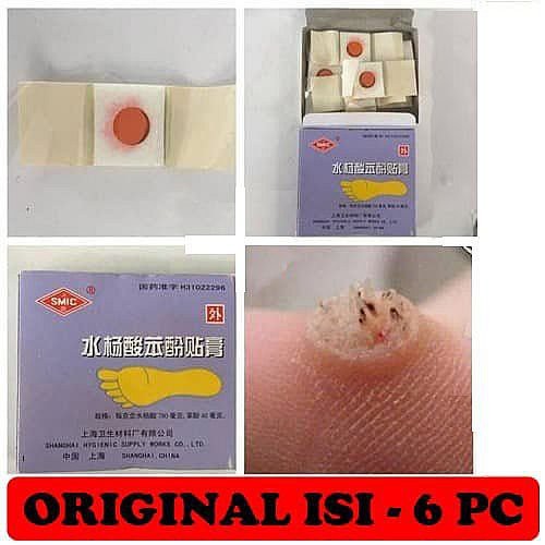 Plester Kutil Mata Ikan Kaki Kapalan Ji Yan Gao Obat Kutil Mata Ikan Kaki Kapalan [1 Box Isi 6Pcs]