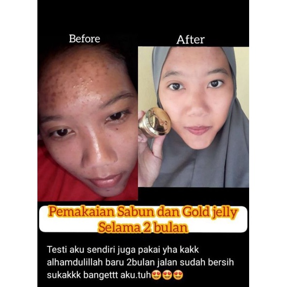 {COD} SABUN ASLI - GOLD JELLY - BODY SERUM KEDAS BEAUTY ORIGINAL