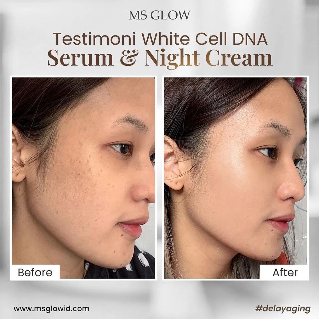 12. Serum White Cell DNA MS Glow Original Official Store