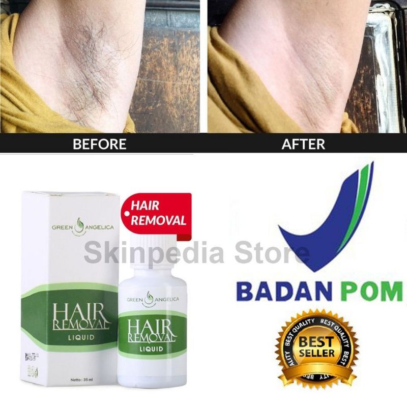 Hair removal green angelica