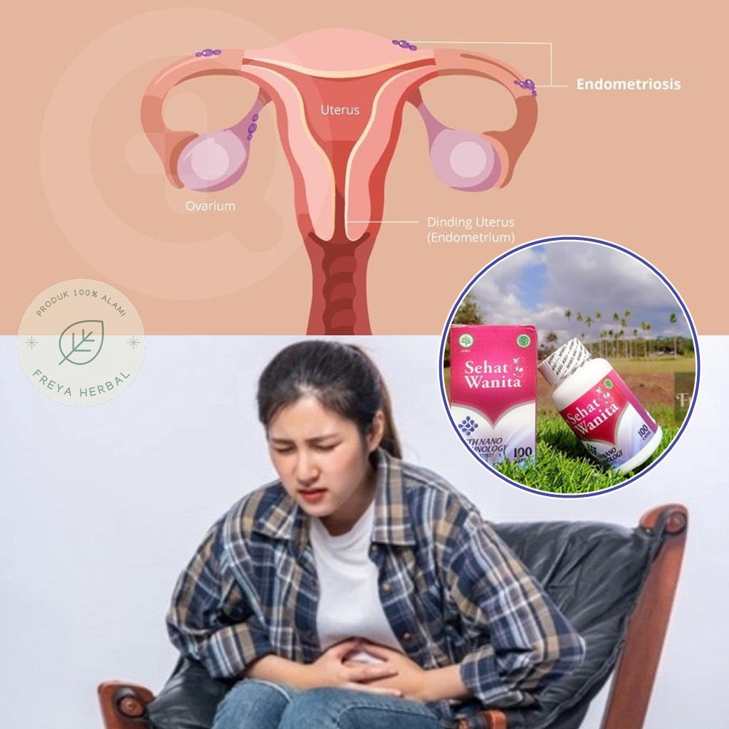 OBAT KISTA ENDOMETRIOSIS, OBAT HERBAL KISTA ENDOMETRIUM, OBAT KISTA OVARIQUM, OBAT KISTA ANGGUR, OBA