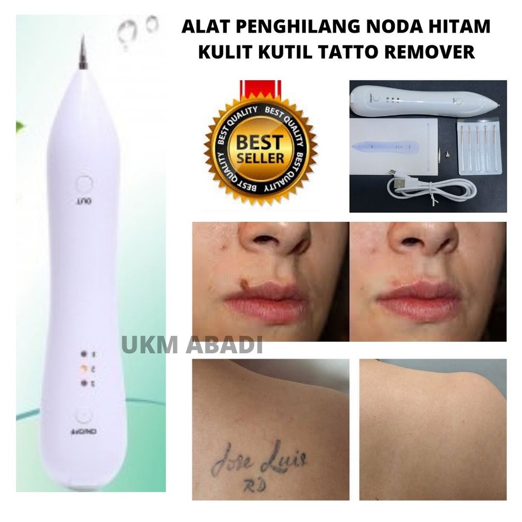 Alat Penghilang Spot Hitam Kulit Kutil Tahi Lalat Tatto Remover Pen 111