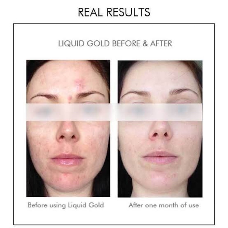 ALPHA - H Liquid Gold with Glycolic Acid Facial Pad