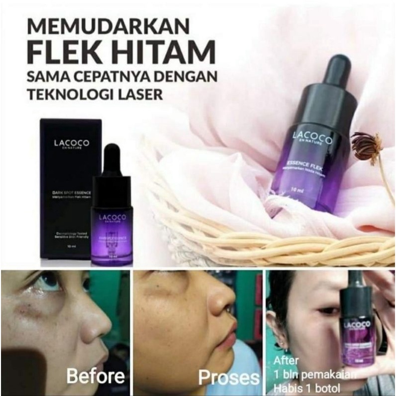 Darkspot Lacoco/Serum lacoco/lcantiflek nasa