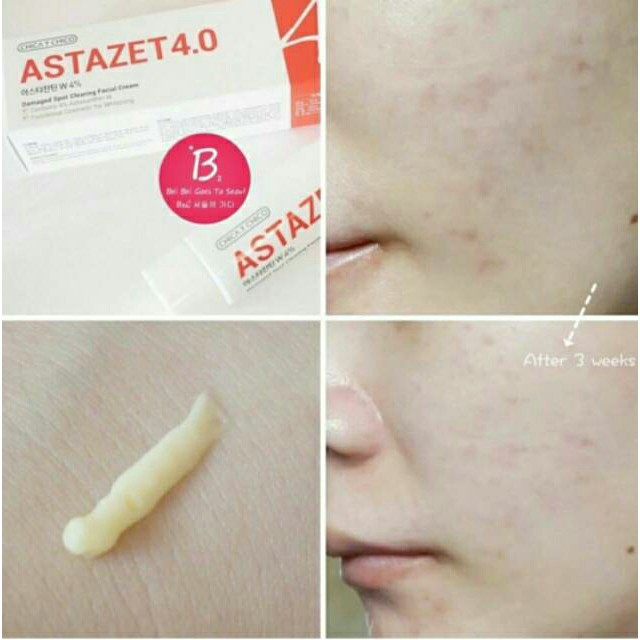 Jual Chica Y Chico Astazet 4 0 Diskon