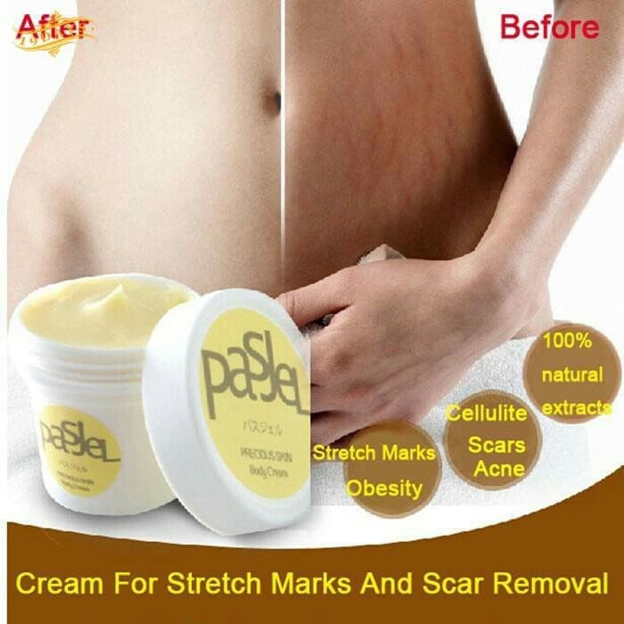 cream pemutih Penghilang Stretch Marks untuk Ibu Hamil