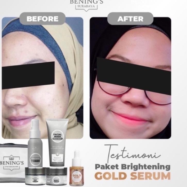 Hot Sale BENINGS SKINCARE DR OKY PRATAMA PAKET BRIGHTENING BENINGS CLINIC/BENINGSCLINIC PENCERAH GLOWING/BENINGCLINIC/BENING CLINIC/BENING SKINCARE DR OKY PRATAMA/BENINGS EXCLUSIVE/FLEK/BENING/BENINGSINDONESIA/BENINGS INDONESIA/BENING INDONESIA/BENINGS AC