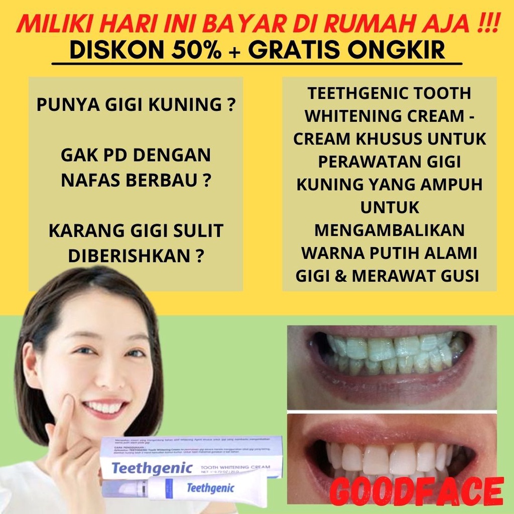 Pemutih Gigi Permanen Teethgenic Tooth Whitening Cream By Ertos Cream Pemutih Gigi