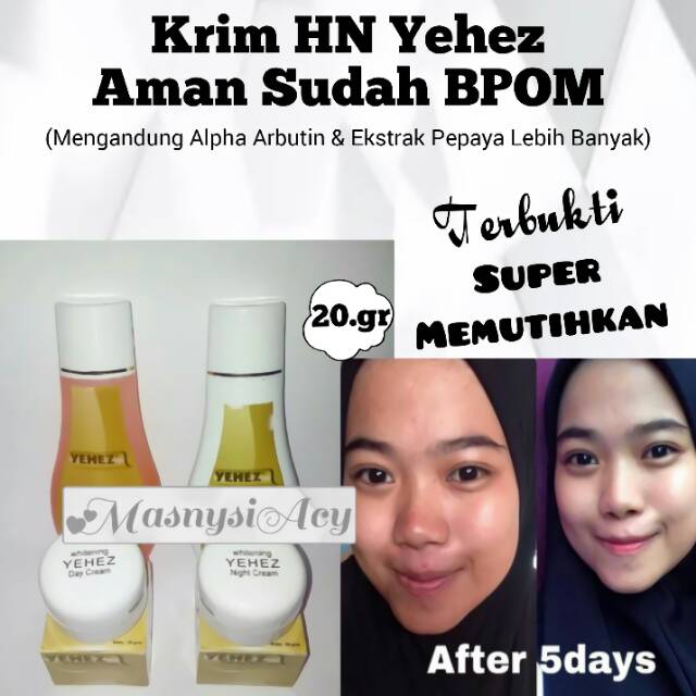 [DiJamin Original] Cream HN YEHEZ BPOM Original | isi 20.gr | hn yehez | BPOM