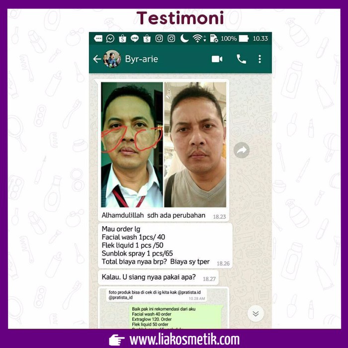 harga murah  Penghilang Flek Hitam di Wajah : Pratista Flek Liquid