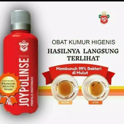 Jual Obat Kumur Sakit Gigi Ampuh Lubang Herbal Mengatasi Amandel Sariawan Gusi Bengkak Mouthwash Joy Polinse Joypolinse Propolis Indonesia Shopee Indonesia