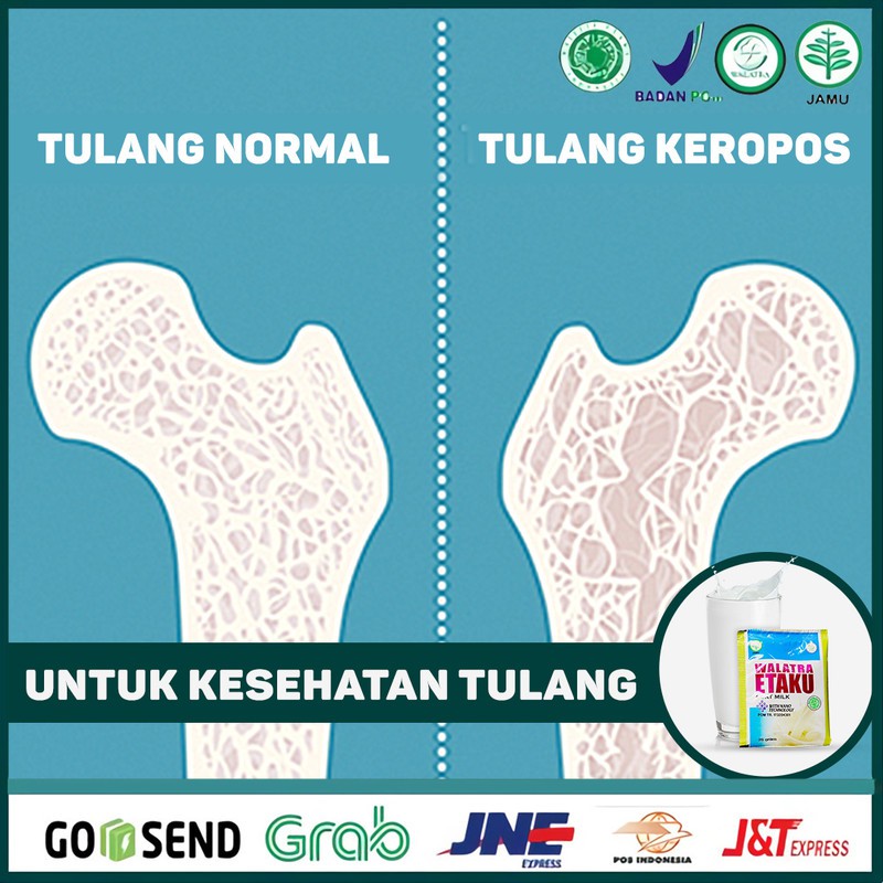 

Susu Kesehatan Tulang - Susu Kalsium - Tulang Keropos Yang Aman Etaku Susu Kambing Asli Di Surabaya