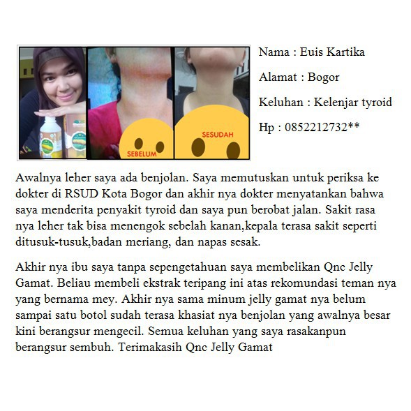 Obat Gondok Beracun Di Leher Kelenjar Tiroid Herbal Qnc Jelly Gamat 300 Ml Aman Untuk Anak Dan Dewasa 100% Original