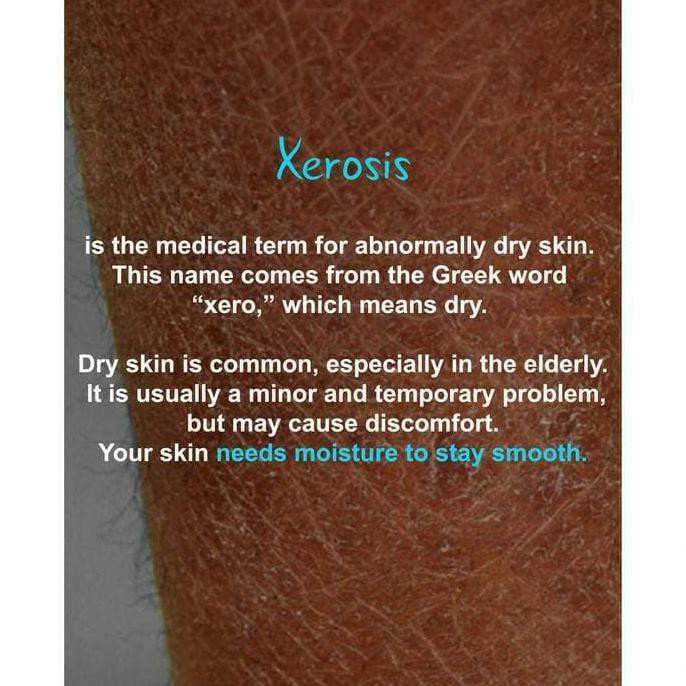 Jual Best Seller / Ready Stock / Ceraderm 100Ml ( Sabun Untuk Kulit Kering,  Dermatitis Dan Sensitif) Indonesia|Shopee Indonesia