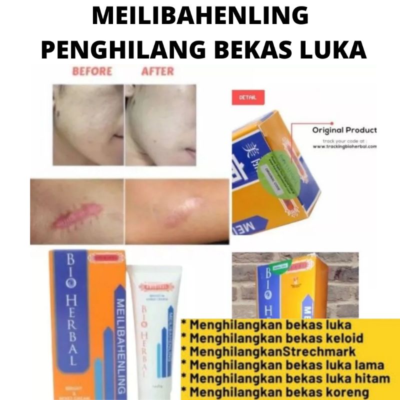 MEILIBAHENLING BIOHERBAL ORIGINAL ASLI BPOM HALAL, CREAM PENGHILANG BEKAS LUKA, KELOID, STRECH MARK, FLEK HITAM, BEKAS CACAR, BEKAS JERAWAT, KORENG DAN BOPENG