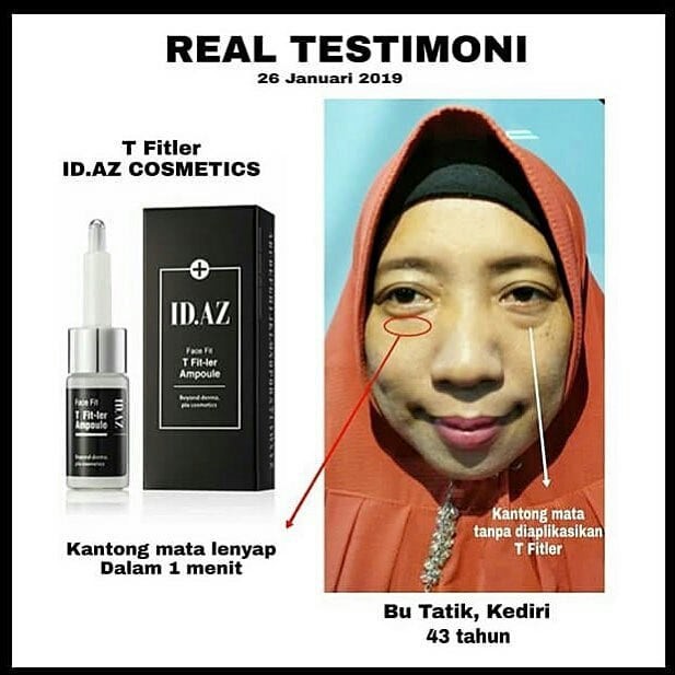 TERBAIK Face Fit T Id Az Serum Penghilang Kantung Mata Kerutan Keriput Wajah Cepat IDAZ 100% BPOM
