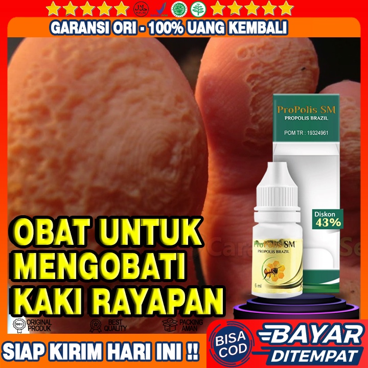Obat Kaki Rayapan, Obat Kaki Pecah Dan Kering, Obat Kaki Rayapan, Obat Telapak Kaki Bolong Berlubang