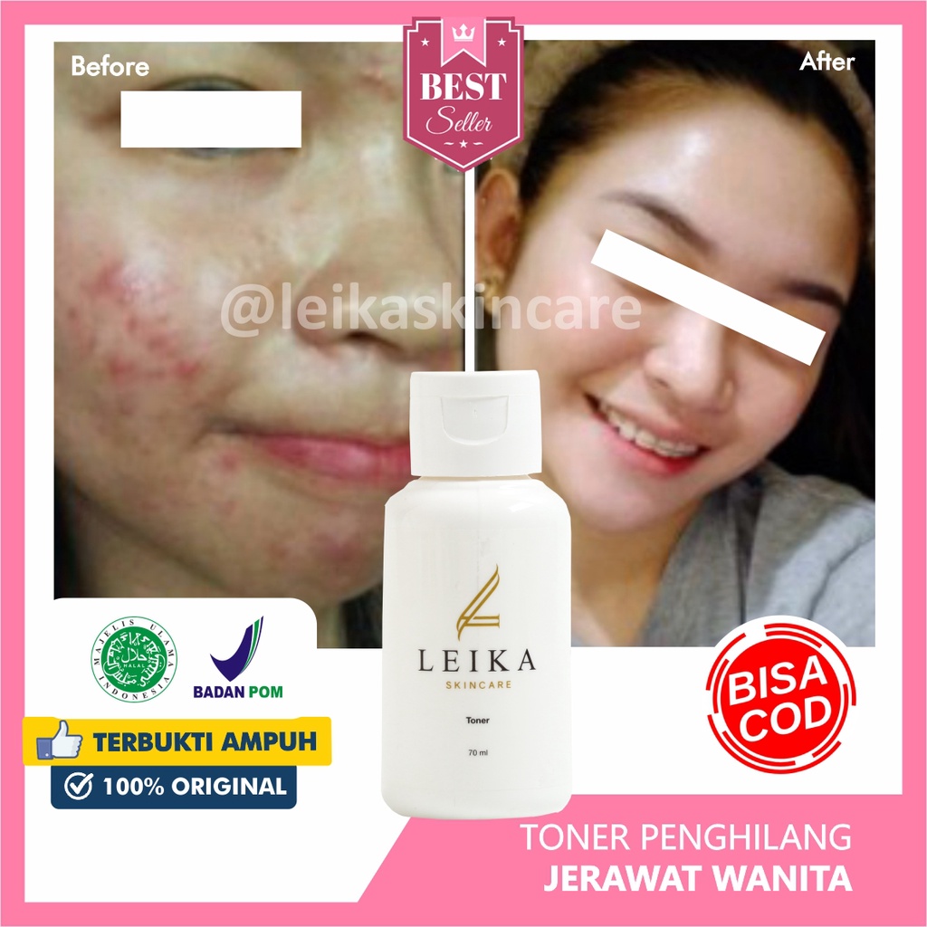 Toner Wajah Mengurangi Wajah Berminyak Toner Wajah Berminyak &amp; Berjerawat Bruntusan BPOM Asli 100% Toner Leika Skincare Halal MUI Original