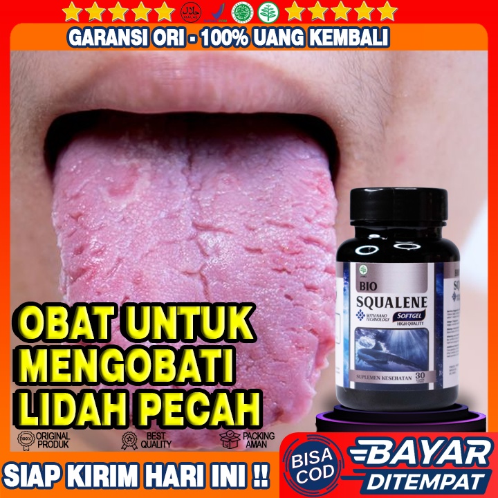 Obat Lidah Pecah Pecah - Obat Lidah Luka - Obat Lidah Putih - Obat Lidah Mati Rasa - Obat Sariawan -