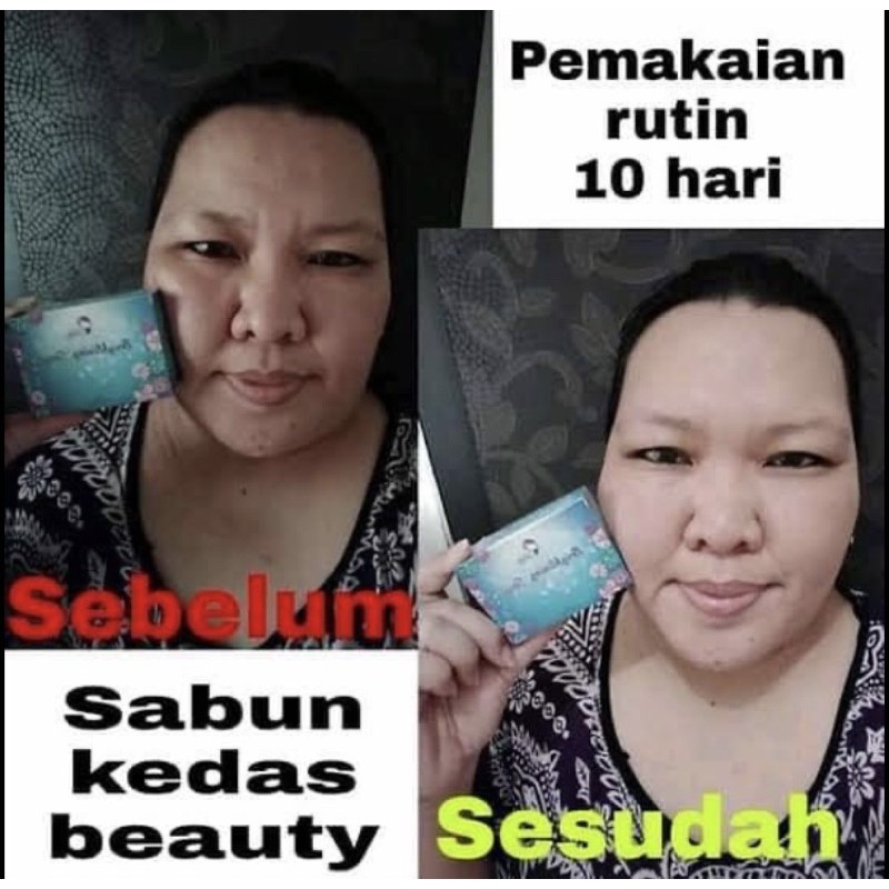 SABUN KEDAS BEAUTY BALI