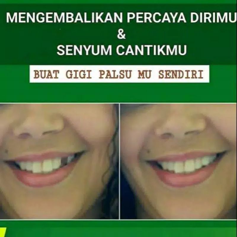 TEMPTOOTH Polymorph Gel Padat untuk buat Gigi Palsu sendiri