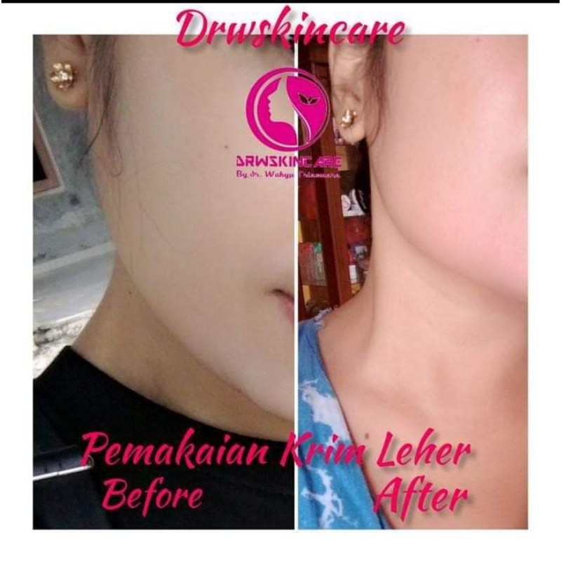 DRW Skincare Brightening Neck Cream Pencerah leher By dr. Wahyu Triasmara