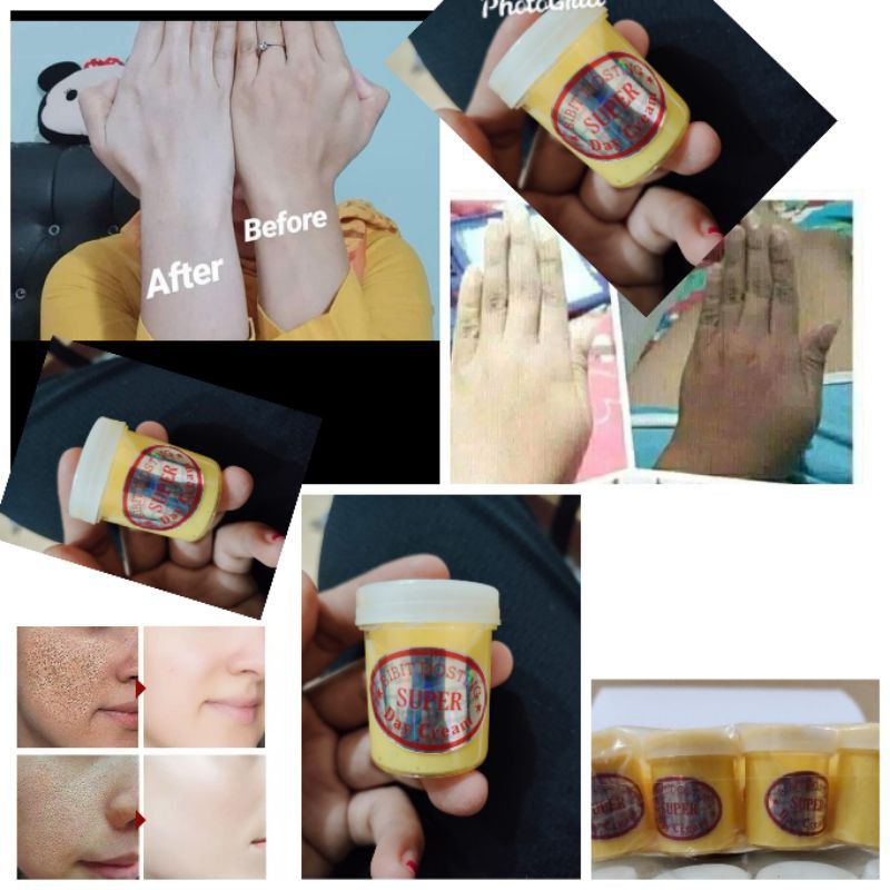 Aschosme BIBIT DOSTING / CREAM Dosting  whitening BDK BDM