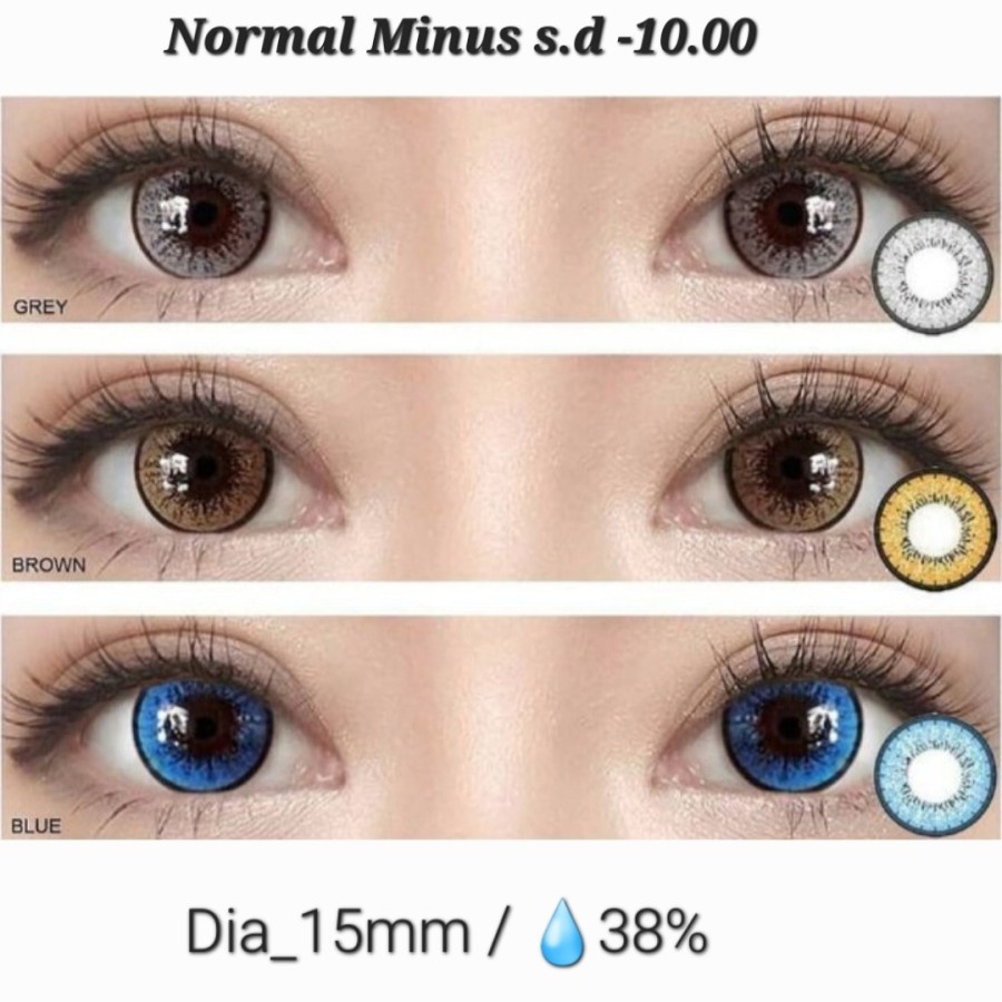 softlens TOPGEL UNIVERSAL BY EOS  0.00 sd 10.00