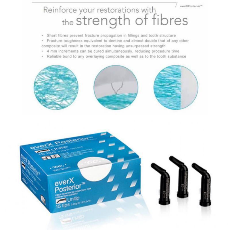 GC everX ever x ecer fiber posterior composite restoration tip tips komposit fiber