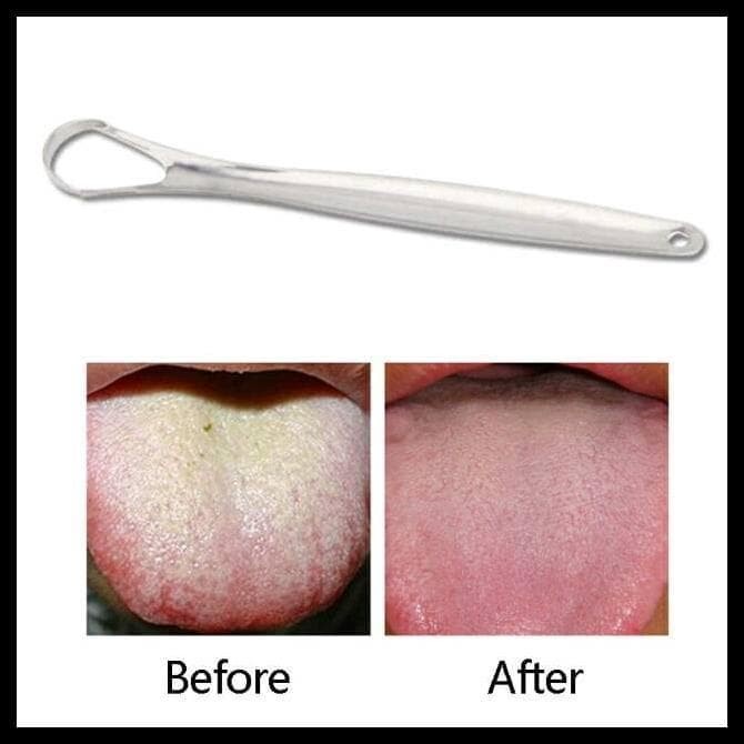 Sikat Pembersih Lidah Stainless Steel Reusable Alat Kebersihan Mulut Gigi Kesehatan tongue brush new