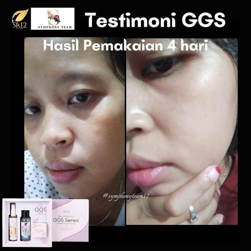 Glow Glass Skin Gel Premium Glasskin Brightening Krim Pemutih Penghilang Bintik Wajah Penghilang Flek Hitam diWajah Brightening Moisture Gel Cream Cream Gel Cream Glowing