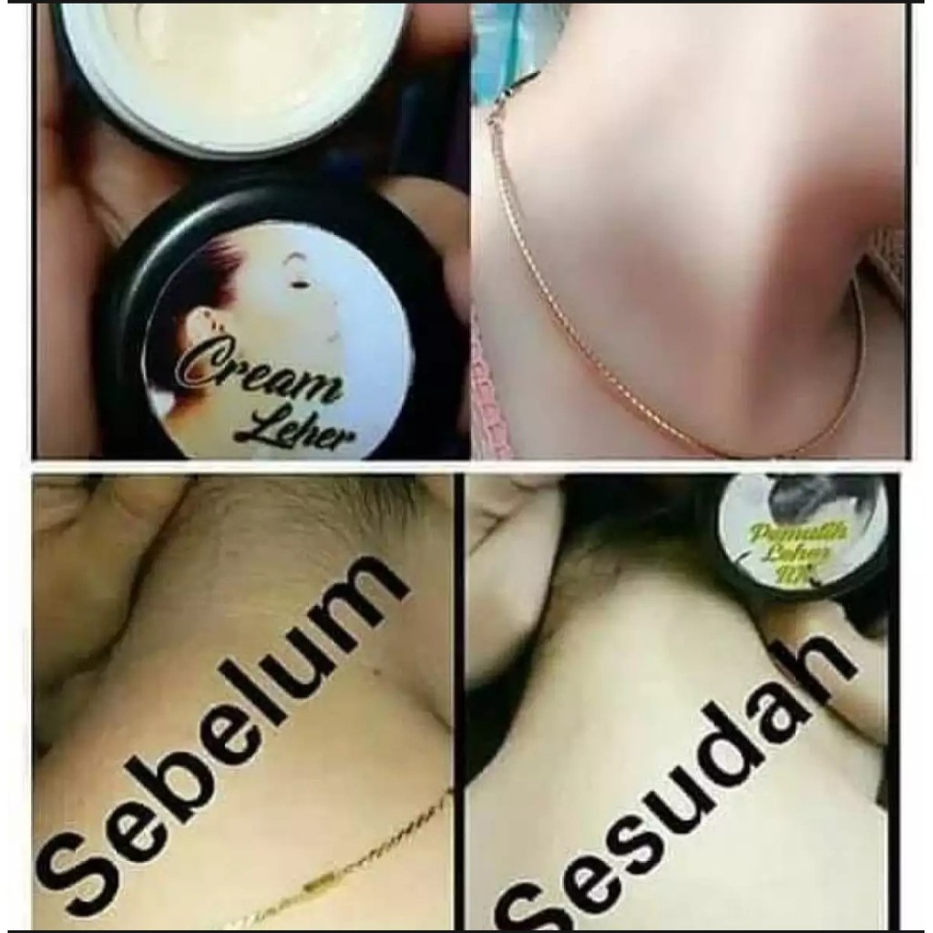 Cream Pemutih Leher BPOM - Toko Mou