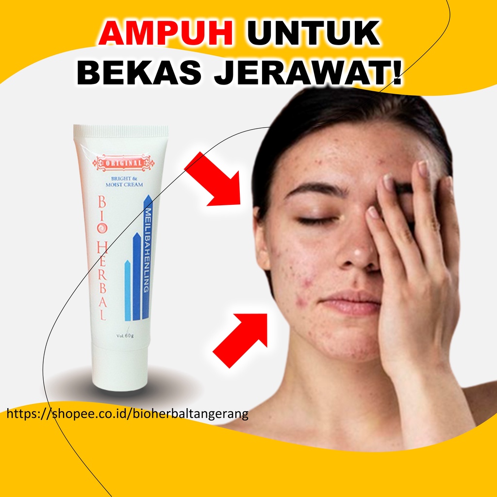 Penghilang Bekas Jerawat Dan Bopeng Ampuh BPOM B13Q