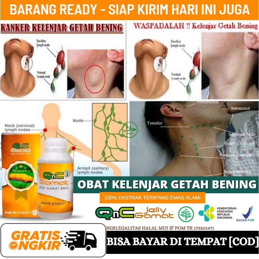 Obat Herbal Kelenjar Getah Bening, Obat Herbal Kelenjar Tiroid, Hiper Tiroid, Benjolan Tumor Jinak