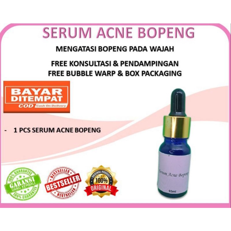 SERUM ACNE bopeng/serum racikan /fh beauty