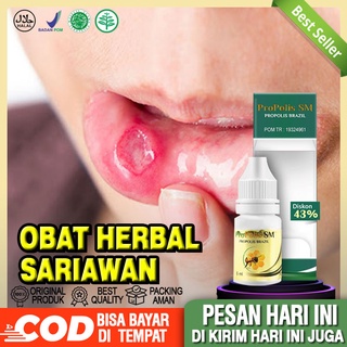 Jual Obat Sariawan Dan Panas Dalam, Obat Sariawan Di Sudut Bibir ...