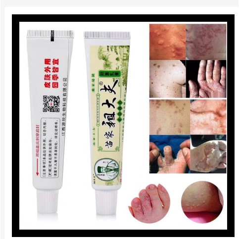 Obat Salep Gatal Gatel Kulit Kurap Jamur Bakteri Zudaifu Herbal-4