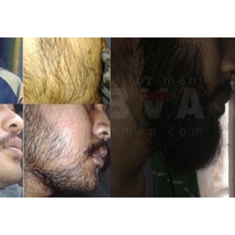 ➴ Beard growth oil ✿