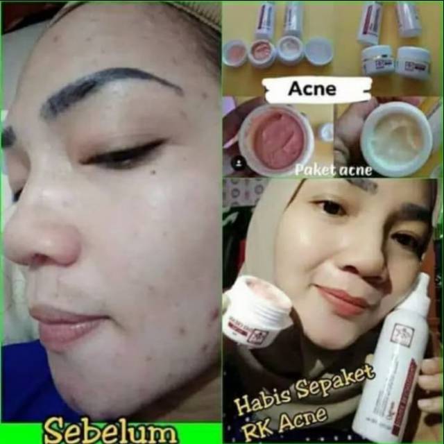 RK Glow Paket Series/ RK Glow Original 100% / BPOM